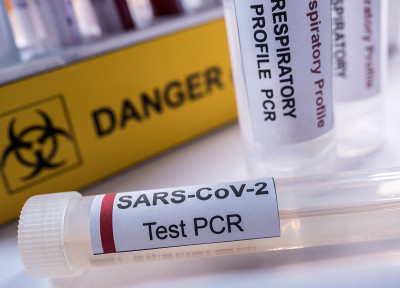SarsCov2冠状病毒的小瓶pcr，概念图