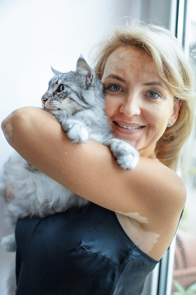 一个成熟的女人患白癜风高兴地拥抱她的猫的肖像