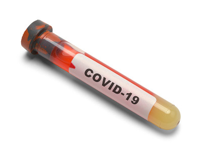 COVID-19血瓶