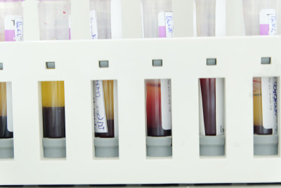 血液学实验室生物样本管