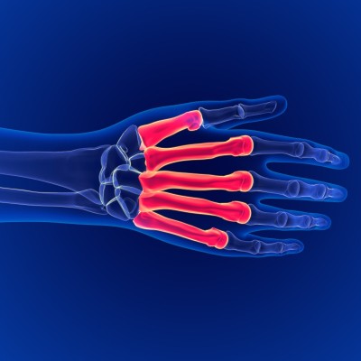 人类骨骼解剖掌骨背侧3D渲染医学概念