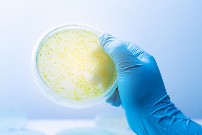 培养基板上蓝藻菌落，微生物学。