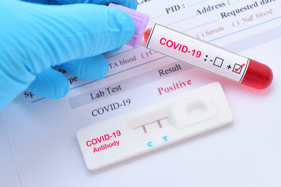 COVID-19病毒快速检测阳性结果