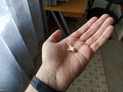 男人的手拿着拔掉的牙齿