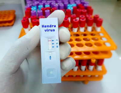 科学家手持式亨德拉病毒快速测试盒，医疗健康理念