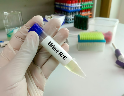 技术员保存尿样进行常规检查、尿样分析
