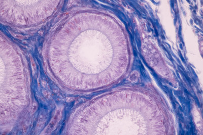 卵巢和睾丸细胞显微镜下的解剖学和组织学研究。
