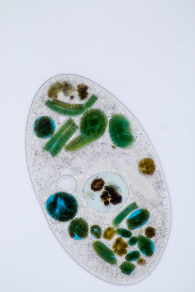在显微镜下，Frontonia sp.是一种自由生活的单细胞纤毛虫原生生物。