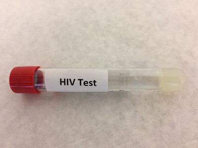 HIV实验室检测用试管