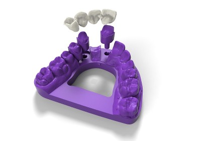3 d渲染假牙