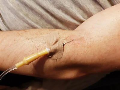 特写照片的男性多毛的手与滴入静脉滴剂