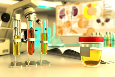 抗坏血酸、维生素c或草酸钙的尿样检验。化学办公室实验室证明，医学3D插图