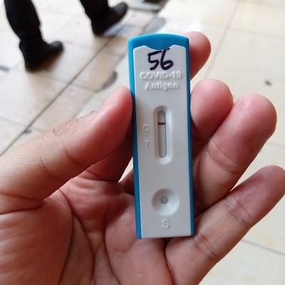 拭子测试包插图照片