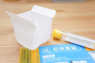 验尿