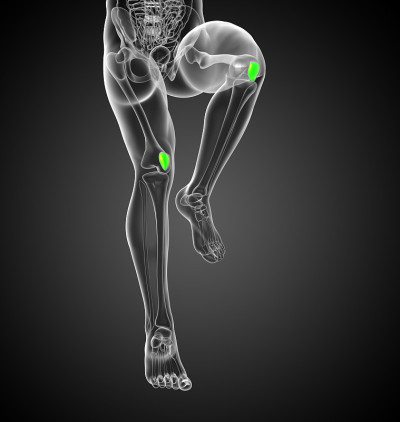 髌骨的3D医学插图