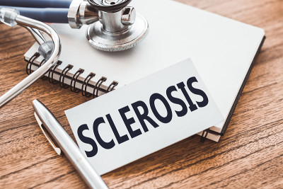 硬化症(SCLEROSIS)这个词写在一张卡片上，放在一张木桌上，旁边是一个听诊器和一个医疗记录笔记