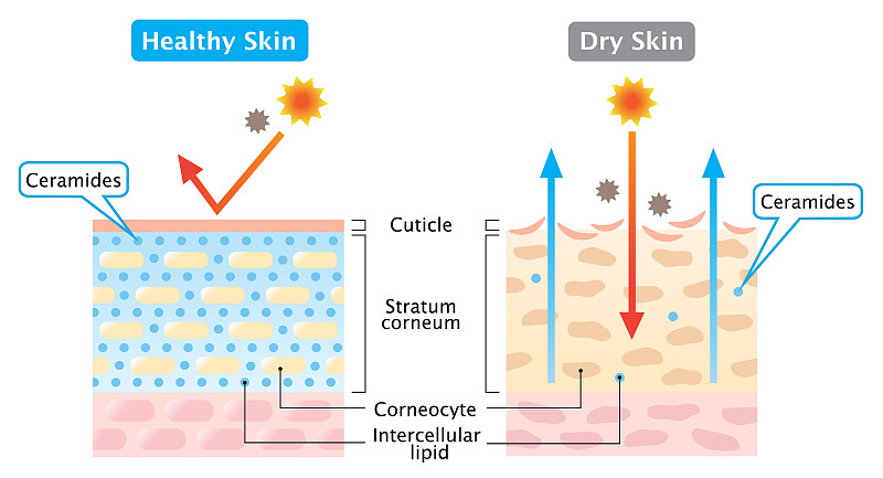 dry and healthy skin layer illustration. beauty an
