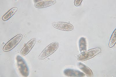 四膜虫是一种单细胞纤毛原生动物