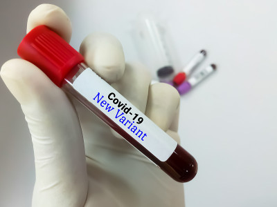 实验室里的医生拿着一管标有Covid-19新毒株的血液。实验室技术员与一种新型冠状病毒的血液样本