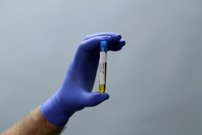 医生手持COVID - 19冠状病毒疫苗