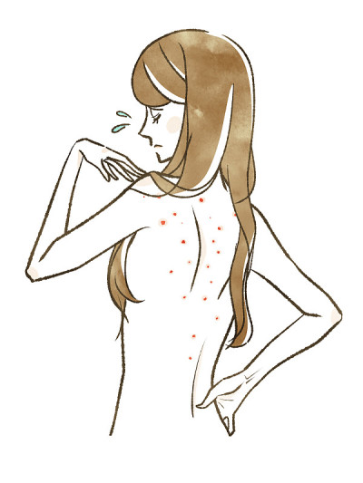 背部皮肤粗糙的女人