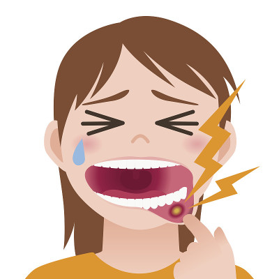 口腔炎，口腔溃疡，口腔黏膜炎症，图像说明