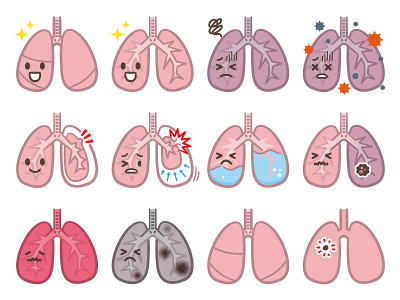 一套肺部疾病插图
