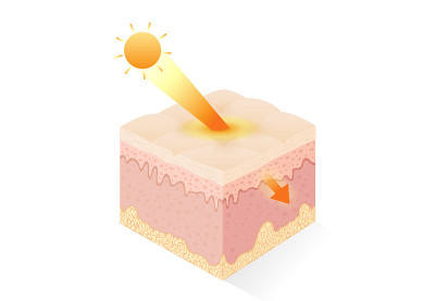 UV ray from Sunlight penetrate into deep human ski