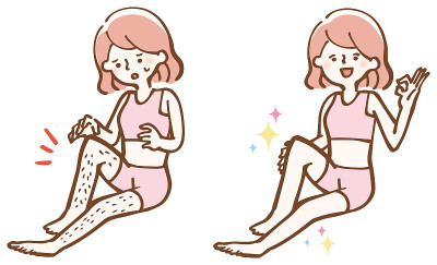 美容脱毛腿女性插图集