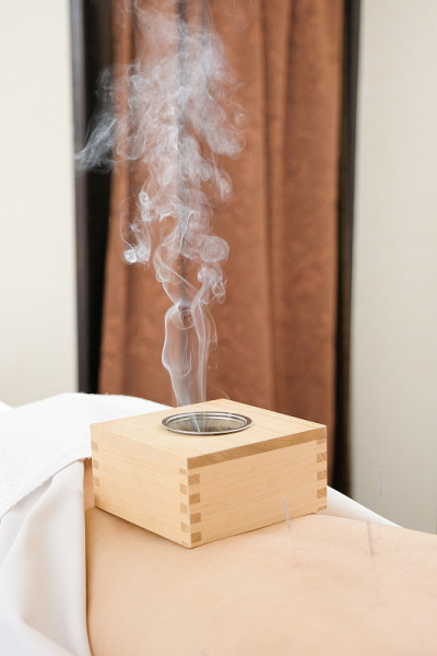 盒灸法放置在女性腰部的一个明亮的针灸中心