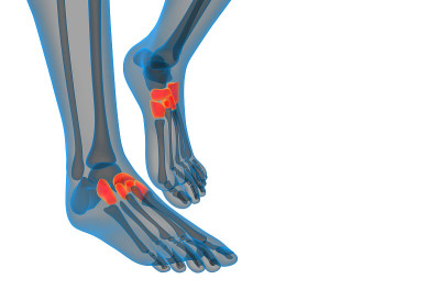 3d渲染医学插图的中足骨