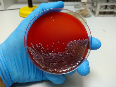 微生物实验室选择性培养基板上细菌培养生长的特写，阴沟肠杆菌。微生物实验室中，在科学家手中的有盖培养皿