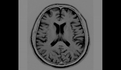 健康男性大脑MRI扫描(磁共振成像)高分辨率