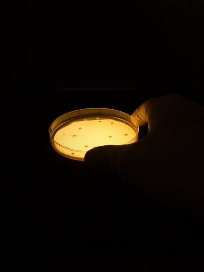 琼脂板上满是微生物和微生物