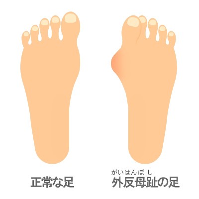 哈卢克斯·瓦尔格斯