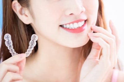 女性使用隐形牙套
