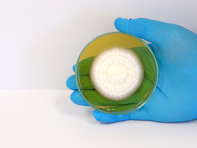 该科学家正拿着装有麦芽提取物琼脂的培养皿，用于在医疗卫生实验室分离和培养酵母菌、霉菌、真菌、青霉菌、