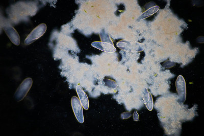 草履虫是一种单细胞纤毛原生动物