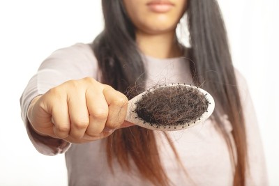 女性对洗发水过敏会导致脱发和头皮屑。