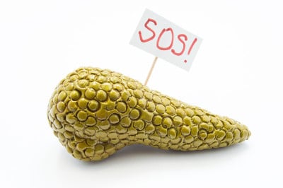 胰腺的三维解剖模型位于白色的背景上，上面写着SOS，向医生或患者寻求医疗帮助、护理或治疗。胰腺疾病症