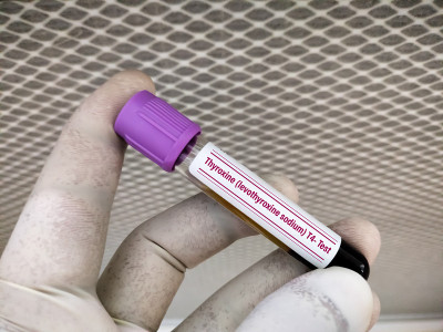 甲状腺素左旋甲状腺素钠T4试验。