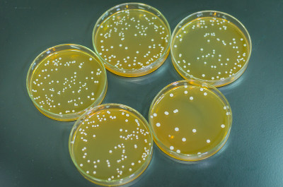 琼脂板上满是微生物和微生物