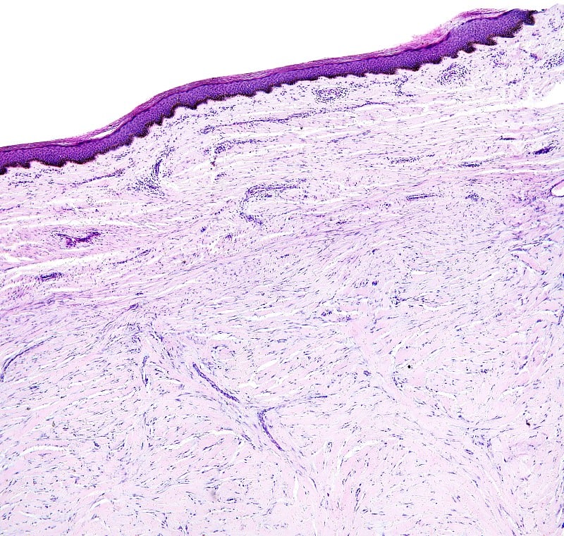 人体组织的组织学，在显微镜下显示皮肤