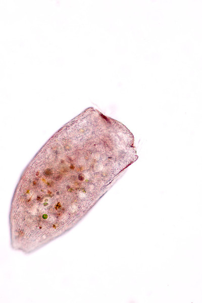 Stentor，有时被称为喇叭微生物，是一种滤食性异养纤毛虫属，是显微镜下废水中异养生物的代表。