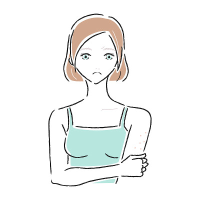 一个有皮肤问题的年轻女人的插图。她上臂上有皮疹。