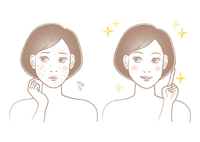 女人的美丽插图。痘痘、斑点和雀斑的烦恼。白色背景。矢量插图。