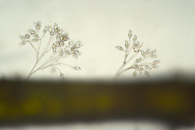 Ciliophora Ciliata Vorticella colonia淡水。微生物