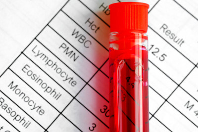 完整的血液样本和血液检测结果。健康和医学概念