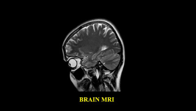 健康男性大脑MRI扫描(磁共振成像)高分辨率