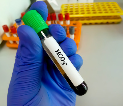 生化学家保存血液样本的HCO3-(碳酸氢盐)离子，电解质